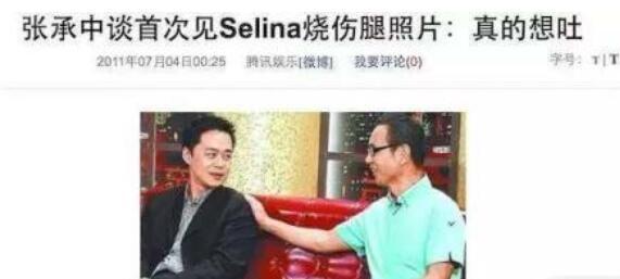 selina张承中演唱会求婚（张承中娶毁容的Selina）(13)