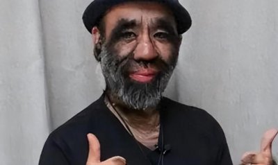 毛孩于震寰:一出生全身是毛,8岁演电影爆红,如今开公司娶娇妻