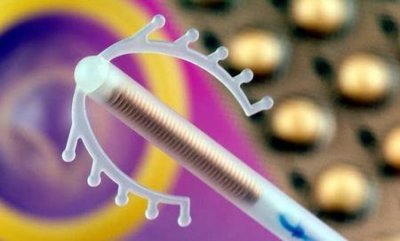 ​节育环对女性的危害