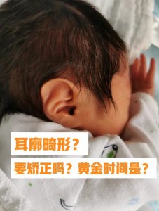 宝宝刚出生耳廓畸形,现在长成什么样了?