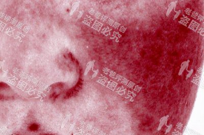 ​敏感肌肤怎样修复（抗敏修复全攻略来了）