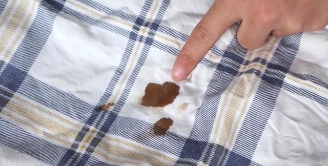 衣服上的血渍怎么去除小窍门百度