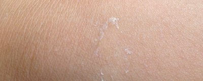 ​沐浴露过期用了会怎样