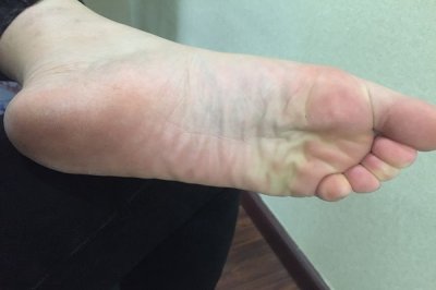 ​足部养生 养生先看脚！脚上有4个特征，说明身体还不错，自查看一看